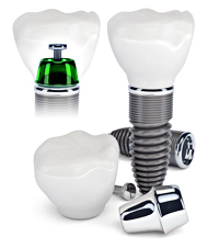 ���ö�Ʈ ����