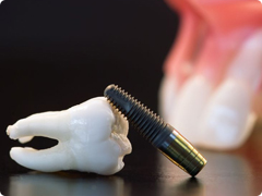 ���ö�Ʈ ����