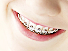 ġ�Ʊ��� ����