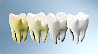 ġ�ƹ̹� ����